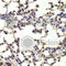 Homeobox protein Hox-B1 antibody, A6619, ABclonal Technology, Immunohistochemistry paraffin image 
