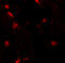 RILP-like protein 2 antibody, 6799, ProSci Inc, Immunofluorescence image 