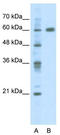 PDZ and LIM domain protein 5 antibody, TA343608, Origene, Western Blot image 
