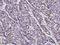 KI-67 antibody, 100130-MM22, Sino Biological, Immunohistochemistry frozen image 