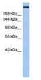 CREB Binding Protein antibody, NBP1-52906, Novus Biologicals, Western Blot image 