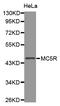 Melanocortin 5 Receptor antibody, MBS127800, MyBioSource, Western Blot image 