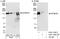 Eukaryotic Translation Initiation Factor 5B antibody, A301-745A, Bethyl Labs, Immunoprecipitation image 