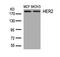 ERBB2 antibody, NB100-81957, Novus Biologicals, Western Blot image 