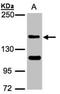 Probable histone-lysine N-methyltransferase NSD2 antibody, NBP1-30910, Novus Biologicals, Western Blot image 