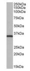 NIMA Related Kinase 7 antibody, orb125093, Biorbyt, Western Blot image 