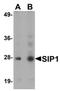 Zinc Finger E-Box Binding Homeobox 2 antibody, orb75449, Biorbyt, Western Blot image 