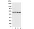 Angiopoietin Like 1 antibody, R30560, NSJ Bioreagents, Western Blot image 