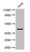 Cysteinyl Leukotriene Receptor 1 antibody, A62370-100, Epigentek, Western Blot image 