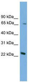 Forkhead Box N2 antibody, TA329631, Origene, Western Blot image 