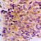 Keratin 10 antibody, LS-C352429, Lifespan Biosciences, Immunohistochemistry paraffin image 