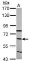 Complement C8 Beta Chain antibody, NBP2-15651, Novus Biologicals, Western Blot image 