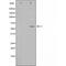 Homeobox A6 antibody, orb226652, Biorbyt, Western Blot image 