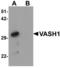 Fibroblast Growth Factor Receptor Like 1 antibody, orb69778, Biorbyt, Western Blot image 