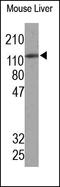 Fms Related Tyrosine Kinase 4 antibody, 251454, Abbiotec, Western Blot image 