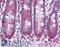 Stromelysin-3 antibody, LS-B2166, Lifespan Biosciences, Immunohistochemistry frozen image 