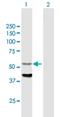 Cytochrome P450 Family 4 Subfamily F Member 12 antibody, H00066002-B01P, Novus Biologicals, Western Blot image 