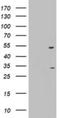 3-Oxoacyl-ACP Synthase, Mitochondrial antibody, NBP2-46304, Novus Biologicals, Western Blot image 