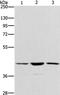 Integrin Binding Sialoprotein antibody, PA5-50633, Invitrogen Antibodies, Western Blot image 
