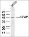 GFAP antibody, orb221420, Biorbyt, Western Blot image 