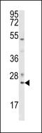 RAB7A, Member RAS Oncogene Family antibody, LS-C162393, Lifespan Biosciences, Western Blot image 