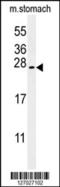 SERTA Domain Containing 3 antibody, 62-106, ProSci, Western Blot image 