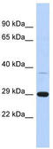 Chromosome 1 Open Reading Frame 74 antibody, TA338863, Origene, Western Blot image 