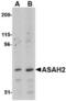 N-Acylsphingosine Amidohydrolase 2 antibody, TA306622, Origene, Western Blot image 