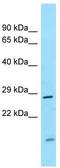 ST6 antibody, TA343300, Origene, Western Blot image 