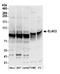 Zinc phosphodiesterase ELAC protein 2 antibody, A304-775A, Bethyl Labs, Western Blot image 