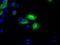 3-Hydroxybutyrate Dehydrogenase 2 antibody, M07970, Boster Biological Technology, Immunofluorescence image 