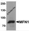 Mitofusin 1 antibody, 7861, ProSci Inc, Western Blot image 