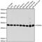 Phosphoglycerate Mutase 1 antibody, GTX64483, GeneTex, Western Blot image 