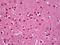 Adenylate Kinase 1 antibody, orb96498, Biorbyt, Immunohistochemistry paraffin image 