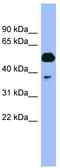 Proteasome 26S Subunit, ATPase 4 antibody, TA345132, Origene, Western Blot image 