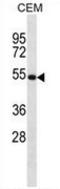 Netrin 3 antibody, AP52952PU-N, Origene, Western Blot image 