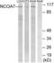 Nuclear Receptor Coactivator 7 antibody, LS-C824349, Lifespan Biosciences, Western Blot image 