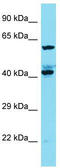 KIAA1841 antibody, TA337391, Origene, Western Blot image 