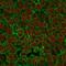 Epithelial Cell Adhesion Molecule antibody, NBP2-33078, Novus Biologicals, Immunofluorescence image 