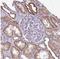 Mitochondrially Encoded NADH:Ubiquinone Oxidoreductase Core Subunit 4 antibody, NBP2-47365, Novus Biologicals, Immunohistochemistry paraffin image 