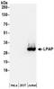 Protein Tyrosine Phosphatase Receptor Type C Associated Protein antibody, NBP2-36565, Novus Biologicals, Western Blot image 