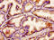 Acyl-CoA Binding Domain Containing 3 antibody, LS-C675102, Lifespan Biosciences, Immunohistochemistry paraffin image 