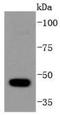 Histone Deacetylase 10 antibody, A05215, Boster Biological Technology, Western Blot image 