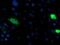 Glutamyl Aminopeptidase antibody, M06961, Boster Biological Technology, Immunofluorescence image 