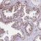 Zinc Finger BED-Type Containing 5 antibody, NBP2-13532, Novus Biologicals, Immunohistochemistry paraffin image 