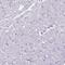 Protein Phosphatase 1 Regulatory Subunit 18 antibody, HPA051000, Atlas Antibodies, Immunohistochemistry frozen image 