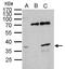 BUD23 RRNA Methyltransferase And Ribosome Maturation Factor antibody, GTX105840, GeneTex, Immunoprecipitation image 