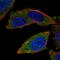 E3 ubiquitin-protein ligase RNF123 antibody, NBP2-57940, Novus Biologicals, Immunofluorescence image 