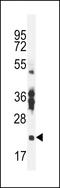 RNA Binding Protein, MRNA Processing Factor 2 antibody, LS-C162509, Lifespan Biosciences, Western Blot image 