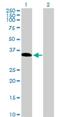 Homeobox protein TGIF2LX antibody, H00090316-B01P, Novus Biologicals, Western Blot image 